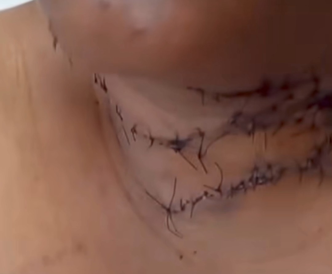 ¡Viva para contarlo! Hombre ataca con una navaja concubina en Sabana Yegua 