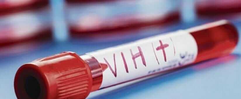 Salud Pública garantiza continuidad de tratamientos para personas con VIH 